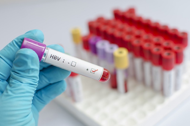 Chi phí xét nghiệm viêm gan B giá bao nhiêu, gồm chỉ định kiểm tra nào?