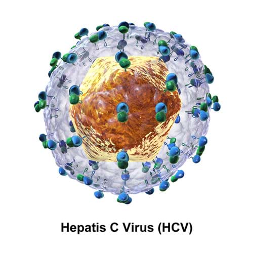 Viêm gan virus C xuất phát từ virus viêm gan C (HCV)