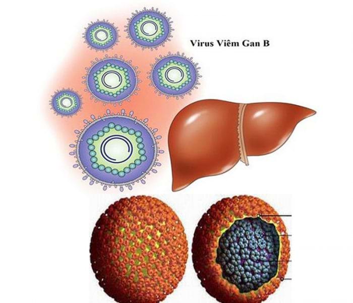Viêm gan virus B cần được phát hiện và chữa trị kịp thời 